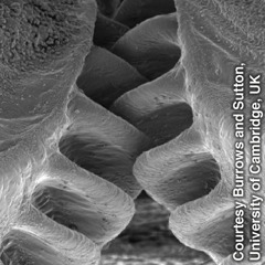 Powiększenie zachodzących na siebie kół zębatych u nasady tylnych odnóży pluskwiaka z gatunku Issus coleoptratus