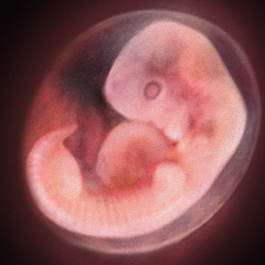 A human embryo