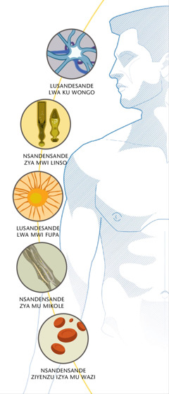 Ulusandesande lwa ku wongo, nsandensande zya mwi linso, lusandesande lwa mwi fupa, nsandensande zya mu mikole, ni nsandensande ziyenzu izya mu wazi