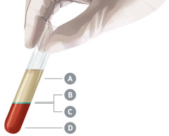 Un tubo de ensaio con sangue separado nos catro compoñentes principais etiquetados como A, B, C e D.