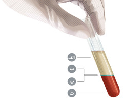 مقداری خون در یک لولهٔ آزمایشگاهی که به چهار بخش اصلی تقسیم و نامگذاری شده است.‏