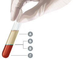 Пробирка, в которой содержится кровь, разделённая на четыре основных компонента (компоненты отмечены буквами А, Б, В и Г).