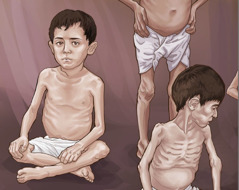 Παιδιά που λιμοκτονούν