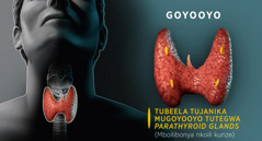 Zifwanikiso: Zifwanikiso zitondezya tubeela itujanika mucizo ca thyroid. 1. Mpocijanika cizo ca thyroid munsingo. 2. Cizo ca parathyroid nkocili kunze.