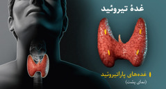 مجموعهٔ تصاویر:‏ عکسی از غدهٔ تیروئید.‏ ۱)‏ نمای روبروی غدهٔ تیروئید،‏ محل آن را در گردن نشان می‌دهد.‏ ۲)‏ نمای پشت غده تیروئید،‏ غده‌های پاراتیروئید را نشان می‌دهد.‏