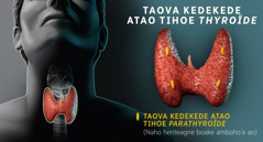 Sare: Sare mampiseho i taova kedekede atao tihoe thyroïde-y. 1. Trea amy i sarey eo ty toeragne misy i thyroïde-y amy i tenday ao naho henteagne boake aloha. 2. Naho henteagne boake amboho’e ao ka i sarey, le trea eo i taova kedekede atao tihoe parathyroïde rey.